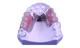 DEDEN-001 Partial Metal Denture