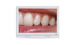 Màn hình LCD Monitor Camera