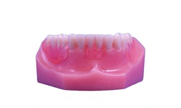 DEDEN-003 Mandibular Non-Clasp Denture