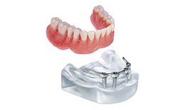 DEDEN-004 Implant Overdentures- Hader Bar