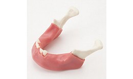 DEIMP-003 Mandible with Soft Tissue