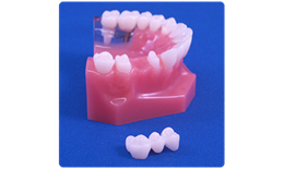 DECB-002 Intermediary Defect Implant (w/transparent window) vs Bridge